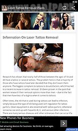 laser tattoo removal tips