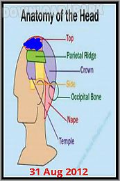 migrainepicad