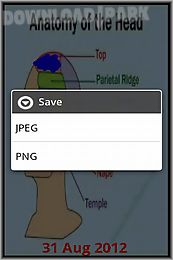 migrainepicad