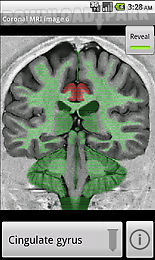 neuroslice