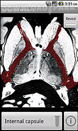neuroslice