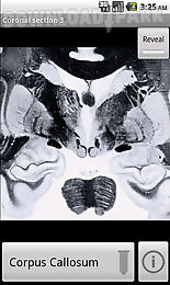 neuroslice