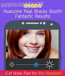 braces teeth booth 2.0