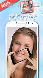 braces teeth booth