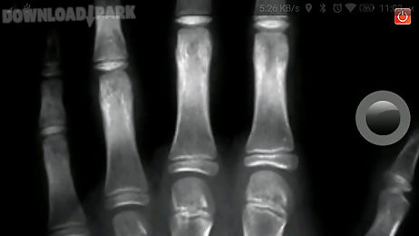 x-ray scanner fun