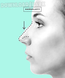 rhinoplasty and nose job