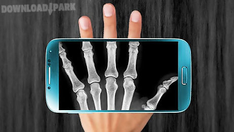 x-ray scanner prank