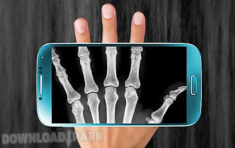 X-ray scanner prank